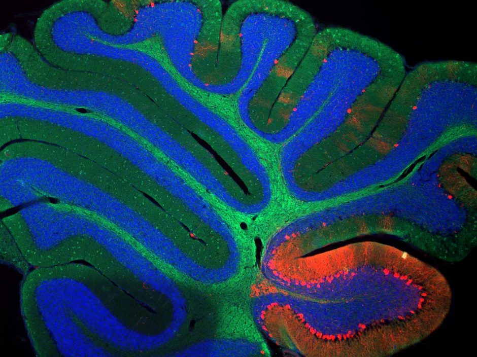 Pattern Recognition: The Math and Science of Mental Reflexes | Herolab